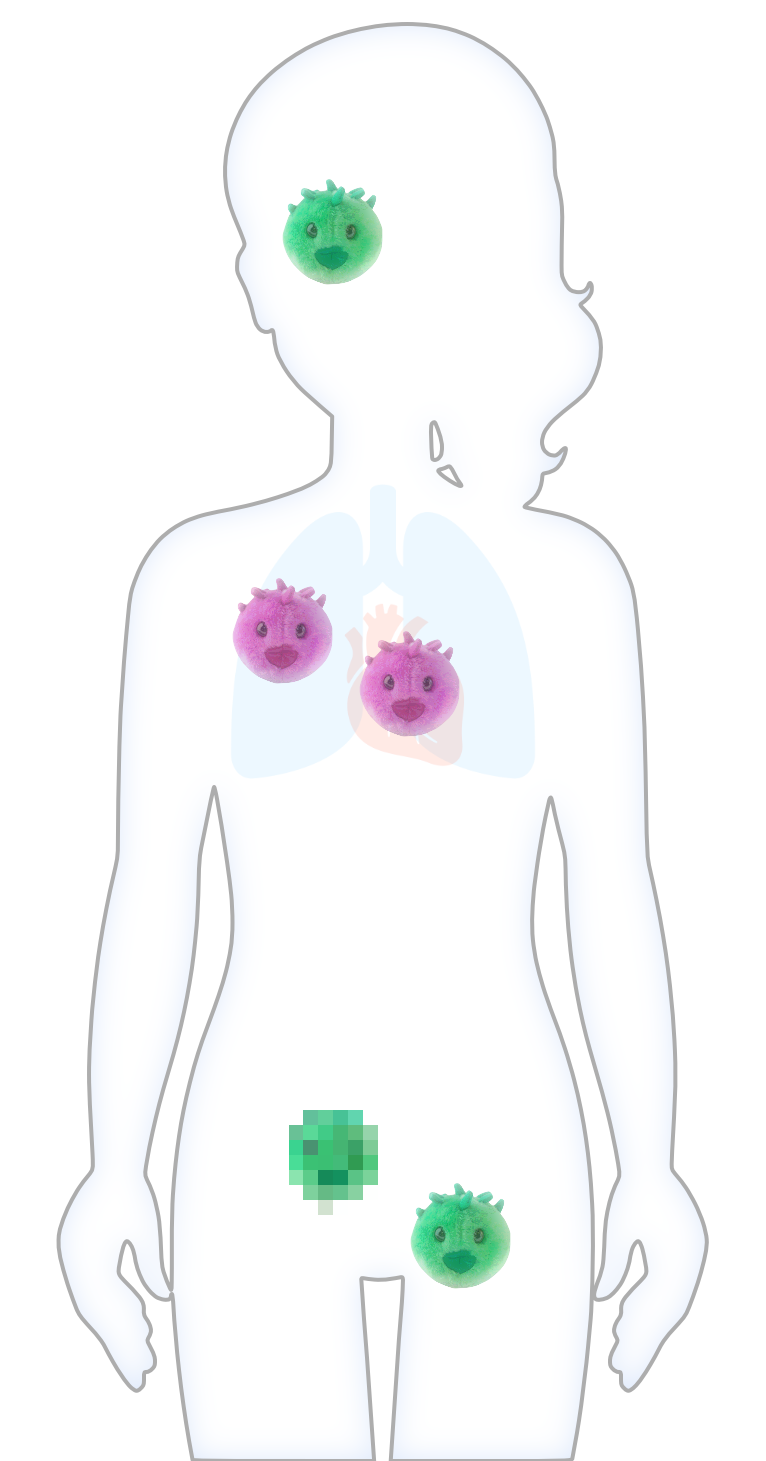 Clinical Chlamydia infections